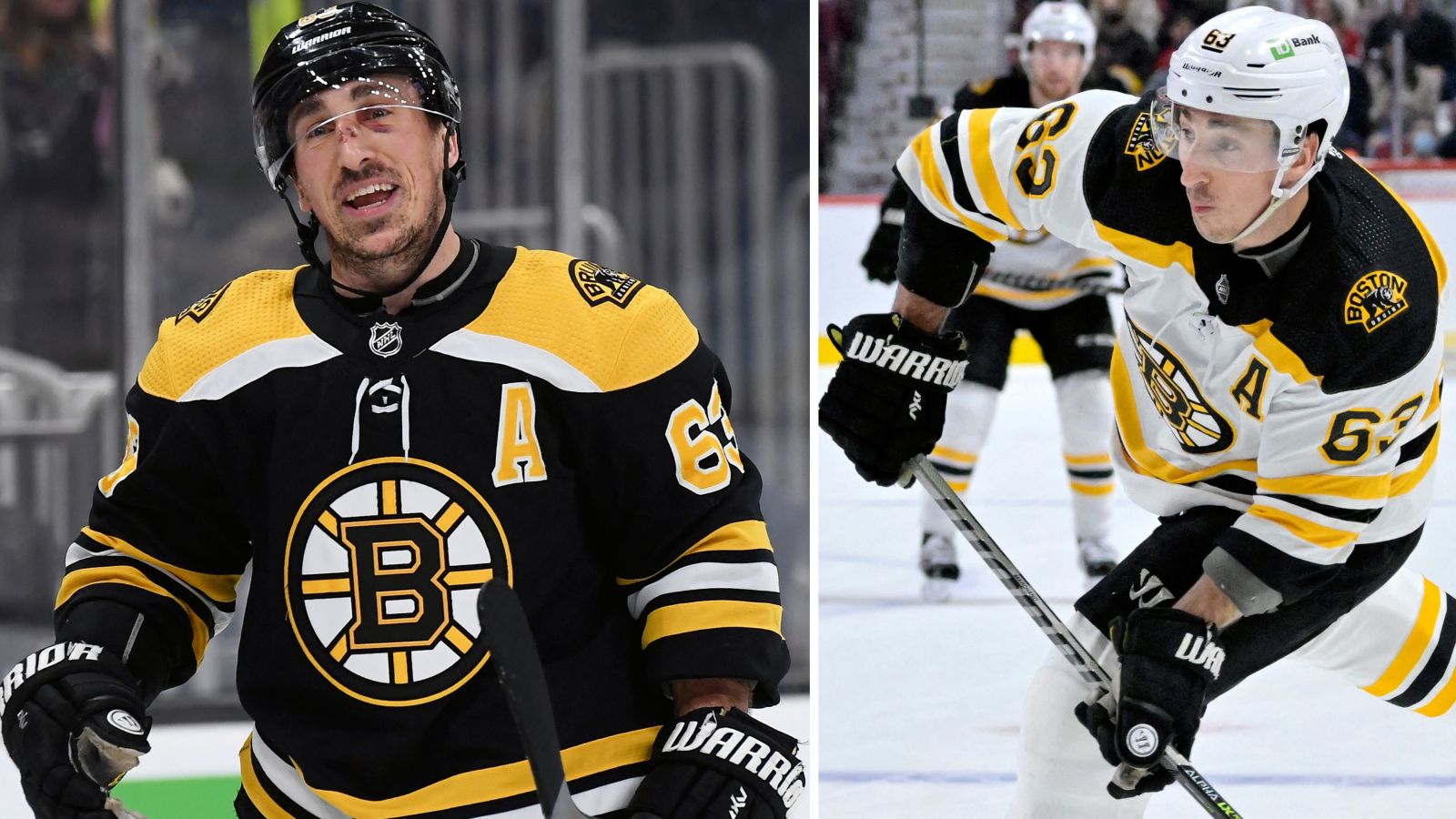 Brad Marchand missar s&auml;songsinledningen &ndash; har opererat h&ouml;fterna
