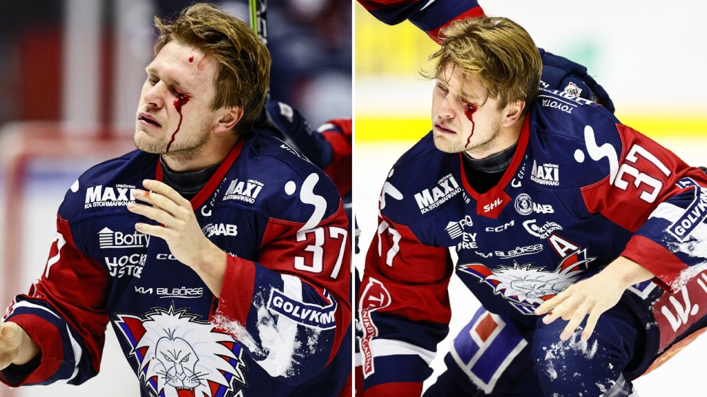 Jesper Pettersson om ot&auml;cka bilderna: &ldquo;Blir orolig f&ouml;r synen&rdquo;