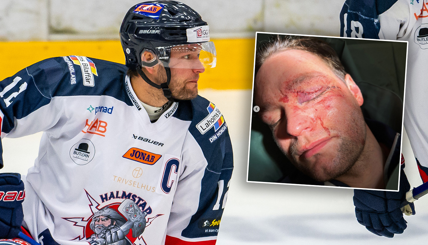 Lugnande besked från Robin Dahse - efter otäcka olyckan: "Änglavakt