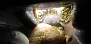 Kan medføre ubehag for hesten – slik forebygger du magebrems