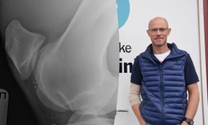 Flere bør sjekke varmblodshesten for løse beinbiter: – Vi veterinærer har stilt spørsmål ved dette i mange år