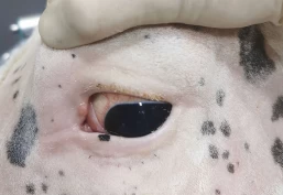 Plateepitelkarsinom – hudkreft i øyeområdet eller på ytre kjønnsorgan