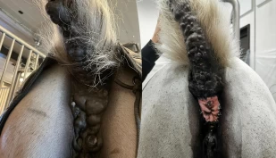 Melanom – hudkrefttypen kjent som «skimmel-kreft»