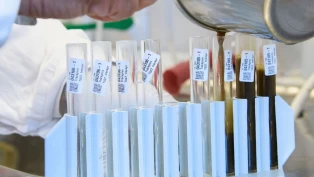 Spolorm har utviklet resistens mot alle tilgjengelige ormekurer for hest