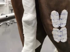 Del 1: Den vanligste helseplagen – hvordan behandler vi hestesår?