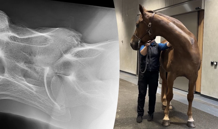 Hiltons problem satt i nakken – en økning i nakkelidelser